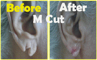 Ear Lobe M Complete Cut.gif (96483 bytes)